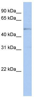 WB Suggested Anti-TBC1D10C Antibody Titration: 0.2-1 ug/ml; ELISA Titer: 1:312500; Positive Control: Jurkat cell lysate
