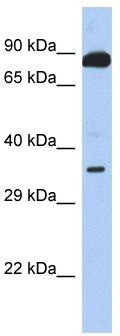 Host: Rabbit; Target Name: TEX9; Sample Tissue: 721_B Whole cell lysates; Antibody Dilution: 1.0 ug/ml