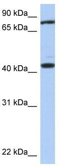 Typical titration curve of Peptide YY in a competitive ELISA with this antibody