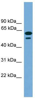 WB Suggested Anti-C19orf45 Antibody Titration: 0.2-1 ug/ml; Positive Control: Transfected 293T