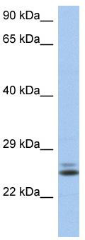 WB Suggested Anti-RAB15 Antibody Titration: 0.2-1 ug/ml; ELISA Titer: 1:62500; Positive Control: THP-1 cell lysate