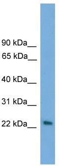 WB Suggested Anti-RAB15 Antibody Titration: 0.2-1 ug/ml; ELISA Titer: 1:1562500; Positive Control: Human Placenta