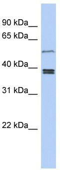 WB Suggested Anti-SS18L1 Antibody Titration: 0.2-1 ug/ml; ELISA Titer: 1:312500; Positive Control: Jurkat cell lysateSS18L1 is supported by BioGPS gene expression data to be expressed in Jurkat