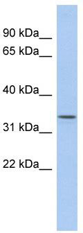 WB Suggested Anti-ZDHHC24 Antibody Titration: 0.2-1 ug/ml; ELISA Titer: 1:1562500; Positive Control: Human Liver
