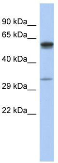 WB Suggested Anti-ZDHHC24 Antibody Titration: 0.2-1 ug/ml; ELISA Titer: 1:62500; Positive Control: Human Small Intestine