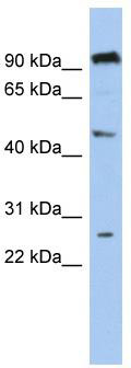 WB Suggested Anti-C1orf174 Antibody Titration: 0.2-1 ug/ml; ELISA Titer: 1:312500; Positive Control: 721_B cell lysateC1orf174 is supported by BioGPS gene expression data to be expressed in 721_B