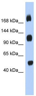 WB Suggested Anti-C2orf55 Antibody Titration: 0.2-1 ug/ml; ELISA Titer: 1:1562500; Positive Control: Human Placenta