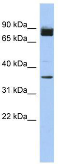 WB Suggested Anti-MGC48628 Antibody Titration: 0.2-1 ug/ml; ELISA Titer: 1:1562500; Positive Control: Human heart