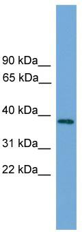WB Suggested Anti-C22orf36 Antibody Titration: 0.2-1 ug/ml; ELISA Titer: 1:312500; Positive Control: 721_B cell lysateFAM211B is supported by BioGPS gene expression data to be expressed in 721_B