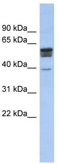 WB Suggested Anti-SPNS2 Antibody Titration: 0.2-1 ug/ml; ELISA Titer: 1:1562500; Positive Control: Human Muscle