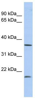 WB Suggested Anti-MTHFD2L Antibody Titration: 0.2-1 ug/ml; ELISA Titer: 1:312500; Positive Control: Human Lung