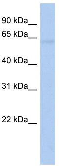 WB Suggested Anti-ODF2L Antibody Titration: 0.2-1 ug/ml; ELISA Titer: 1:312500; Positive Control: 721_B cell lysate