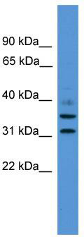WB Suggested Anti-GIMAP6 Antibody Titration: 0.2-1 ug/ml; ELISA Titer: 1:312500; Positive Control: THP-1 cell lysate