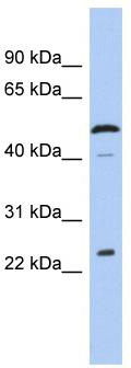WB Suggested Anti-C1orf190 Antibody Titration: 0.2-1 ug/ml; ELISA Titer: 1:312500; Positive Control: Jurkat cell lysate