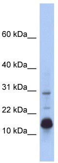 WB Suggested Anti-HIST2H2BF Antibody Titration: 0.2-1 ug/ml; ELISA Titer: 1:62500; Positive Control: Human Small Intestine