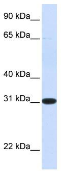 WB Suggested Anti-PBLD Antibody Titration: 0.2-1 ug/ml; ELISA Titer: 1:312500; Positive Control: Human Liver