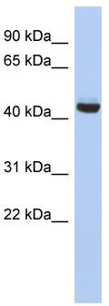 WB Suggested Anti-EXOC4 Antibody Titration: 0.2-1 ug/ml; ELISA Titer: 1:62500; Positive Control: Jurkat cell lysate
