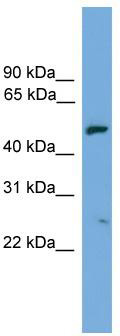 WB Suggested Anti-EXOC4 Antibody Titration: 0.2-1 ug/ml; ELISA Titer: 1:312500; Positive Control: Human Placenta
