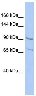 WB Suggested Anti-RALGDS Antibody Titration: 0.2-1 ug/ml; ELISA Titer: 1:312500; Positive Control: HepG2 cell lysate