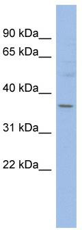 WB Suggested Anti-HMGCLL1 Antibody Titration: 0.2-1 ug/ml; ELISA Titer: 1:1562500; Positive Control: OVCAR-3 cell lysate