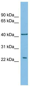 WB Suggested Anti-RALB Antibody Titration: 0.2-1 ug/ml; ELISA Titer: 1:1562500; Positive Control: ACHN cell lysateRALB is strongly supported by BioGPS gene expression data to be expressed in Human ACHN cells