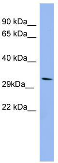 WB Suggested Anti-RRAD Antibody Titration: 0.2-1 ug/ml; ELISA Titer: 1:312500; Positive Control: HepG2 cell lysate