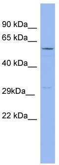 WB Suggested Anti-RRAD Antibody Titration: 0.2-1 ug/ml; ELISA Titer: 1: 1562500; Positive Control: MCF7 cell lysate