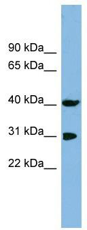 WB Suggested Anti-PPID Antibody Titration: 0.2-1 ug/ml; ELISA Titer: 1:1562500; Positive Control: NCI-H226 cell lysate