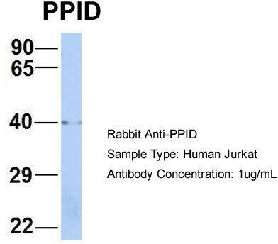 Host: Rabbit; Target Name: PPID; Sample Tissue: Human Jurkat; Antibody Dilution: 1.0 ug/ml; PPID is strongly supported by BioGPS gene expression data to be expressed in Jurkat