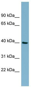 WB Suggested Anti-MOS Antibody Titration: 0.2-1 ug/ml; ELISA Titer: 1:12500; Positive Control: NCI-H226 cell lysateMOS is supported by BioGPS gene expression data to be expressed in NCIH226
