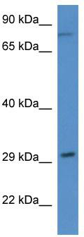 WB Suggested Anti-Rad21 Antibody; Titration: 1.0 ug/ml; Positive Control: Rat Heart