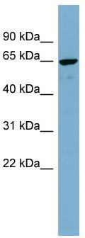 WB Suggested Anti-NOP5 Antibody Titration: 0.2-1 ug/ml; ELISA Titer: 1:312500; Positive Control: MCF7 cell lysate