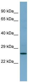 Western blot analysis of extracts of various cell lines, using Pan Cadherin antibody (TA374523) at 1:3000 dilution.|Secondary antibody: HRP Goat Anti-Rabbit IgG (H+L) at 1:10000 dilution.|Lysates/proteins: 25ug per lane.|Blocking buffer: 3% nonfat dry milk in TBST.|Detection: ECL Basic Kit .|Exposure time: 1s.