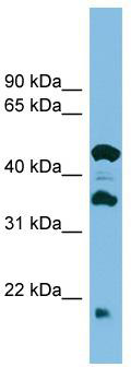 WB Suggested Anti-C11orf73 Antibody Titration: 0.2-1 ug/ml; ELISA Titer: 1:1562500; Positive Control: ACHN cell lysate