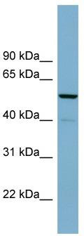 WB Suggested Anti-CDK5RAP1 Antibody Titration: 0.2-1 ug/ml; ELISA Titer: 1:1562500; Positive Control: Human brain
