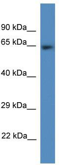 WB Suggested Anti-Cdk5rap1 Antibody; Titration: 1.0 ug/ml; Positive Control: Rat Heart