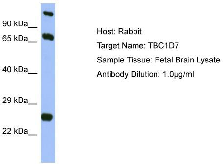Host: Rabbit; Target Name: TBC1D7; Sample Tissue: Fetal Brain lysates; Antibody Dilution: 1.0 ug/ml