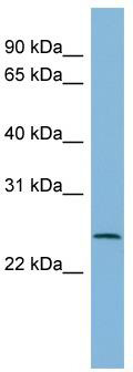 WB Suggested Anti-CXorf26 Antibody Titration: 0.2-1 ug/ml; ELISA Titer: 1:312500; Positive Control: HT1080 cell lysate