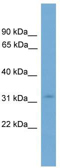 WB Suggested Anti-KRCC1 Antibody Titration: 0.2-1 ug/ml; Positive Control: ACHN cell lysateKRCC1 is supported by BioGPS gene expression data to be expressed in ACHN