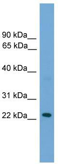 WB Suggested Anti-RAB39 Antibody Titration: 0.2-1 ug/ml; ELISA Titer: 1:312500; Positive Control: Hela cell lysate