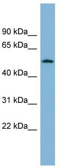WB Suggested Anti-C2orf29 Antibody Titration: 0.2-1 ug/ml; ELISA Titer: 1:1562500; Positive Control: Human Thymus