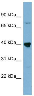 WB Suggested Anti-WDR55 Antibody Titration: 0.2-1 ug/ml; ELISA Titer: 1:1562500; Positive Control: Jurkat cell lysateWDR55 is supported by BioGPS gene expression data to be expressed in Jurkat