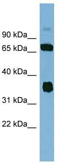 WB Suggested Anti-OSGEP Antibody Titration: 0.2-1 ug/ml; ELISA Titer: 1:312500; Positive Control: MCF7 cell lysate
