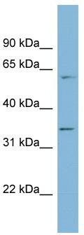 WB Suggested Anti-OSGEP Antibody Titration: 0.2-1 ug/ml; ELISA Titer: 1:1562500; Positive Control: 721_B cell lysateOSGEP is supported by BioGPS gene expression data to be expressed in 721_B