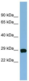 WB Suggested Anti-CHCHD3 Antibody Titration: 0.2-1 ug/ml; Positive Control: Hela cell lysate