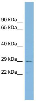 WB Suggested Anti-CHCHD3 Antibody Titration: 0.2-1 ug/ml; Positive Control: Human Placenta