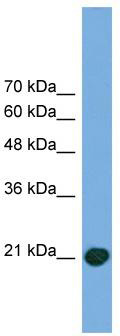 WB Suggested Anti-COMMD8 Antibody Titration: 0.2-1 ug/ml; Positive Control: Transfected 293T