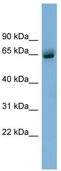 WB Suggested Anti-SLFN12 Antibody Titration: 0.2-1 ug/ml; ELISA Titer: 1:312500; Positive Control: Human Stomach