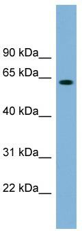 WB Suggested Anti-SLFN12 Antibody Titration: 0.2-1 ug/ml; ELISA Titer: 1:62500; Positive Control: Human Thymus