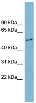 WB Suggested Anti-FAM90A1 Antibody Titration: 0.2-1 ug/ml; Positive Control: Jurkat cell lysate